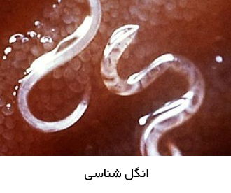 انگل شناسی